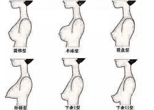 因为支撑乳房的弹性组织变得松弛,有时会下垂至正常位置以下3至4英寸