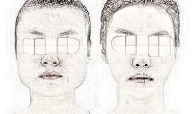 做面部轮廓都有哪些人?哪里做比较好?