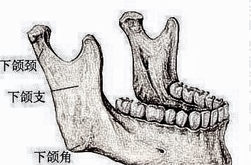 上海整形医生建议我做下颌角手术，有必要吗？