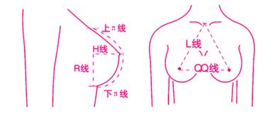 自体脂肪隆胸你真的了解吗?