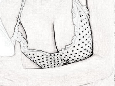 徐州华美整形做假体隆胸多少钱 女人“挺”好才更美