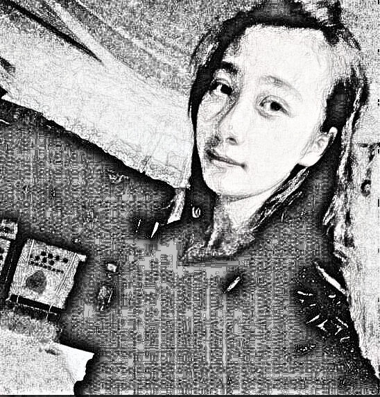 做了双眼皮 现在好激动啊 - 美尔贝刘医生 - 刘医生的整容 有点小激动的去做了双眼皮,术后居然。。
