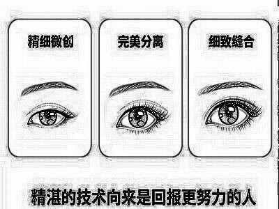 埋线双眼皮后能保持多久啊