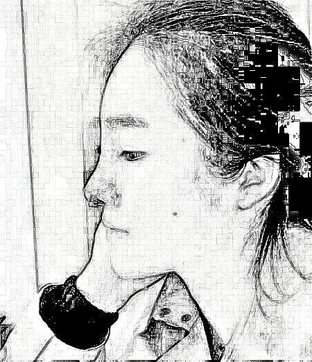 上海第九医院做了隆鼻后,我也是拥有小翘鼻的人啦