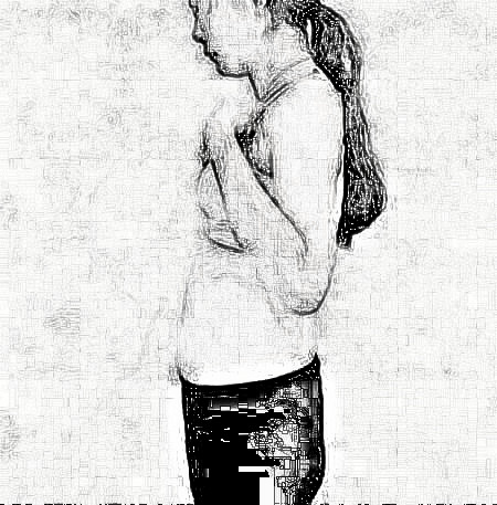 郑州悦美整形做的做吸脂瘦腰腹+瘦大腿,术后60天分享福图