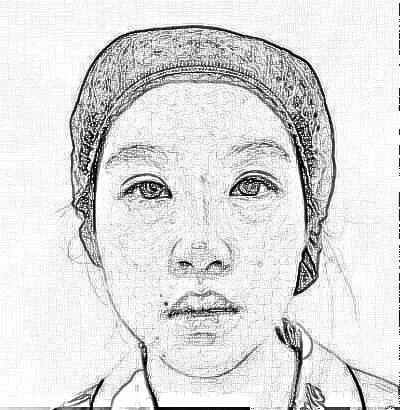 天津伊颂整形做眼部手术整形怎么样?术后80天介绍果分享