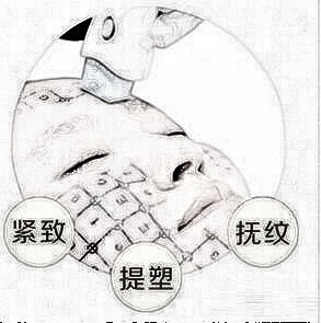 常熟瑞丽热玛吉除皱的优势