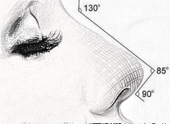  自贡隆鼻手术医院哪家口碑好 假体隆鼻多久能恢复