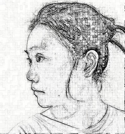 郑州乡南整形医院找闫江涛做鼻部手术,术后30天恢复果分享
