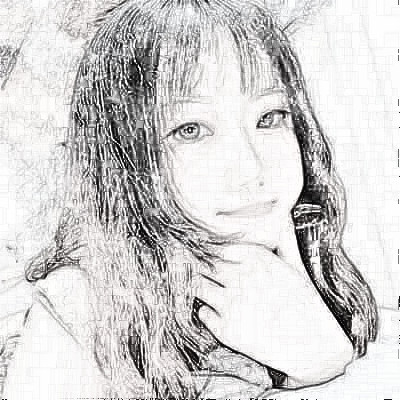 成都美立方医院找张娟做的眼部手术怎么样?恢复一览