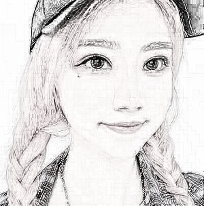 成都美立方医院找张娟做的眼部手术怎么样?恢复一览