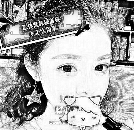 深圳尹卫民隆鼻好不好?看看介绍如何