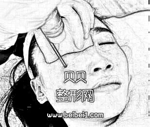 杭州格莱美激光祛斑介绍分享~附整形