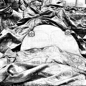深圳鹏程医院的马强医生做隆胸的果好嘛?附假体+自体脂肪复合隆胸介绍