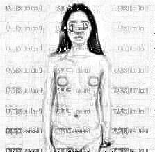 深圳鹏程医院的马强医生做隆胸的果好嘛?附假体+自体脂肪复合隆胸介绍