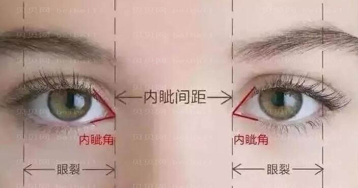 深圳米兰柏羽美杜莎 朱武根双眼皮怎么样?介绍