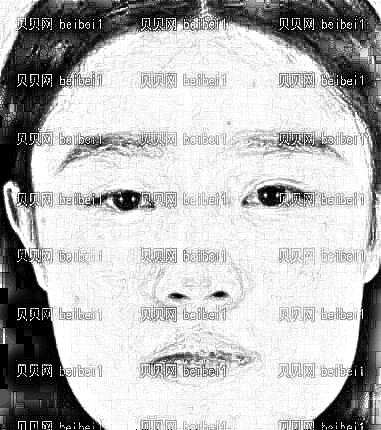 北京八大处靳小雷下颌角磨骨介绍分享:从20岁开始变美了!