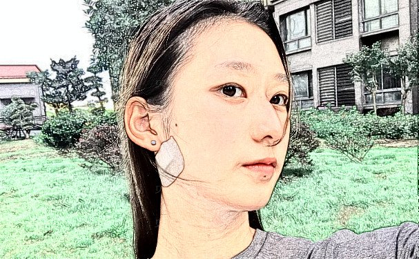 襄阳玻尿酸除颈纹实力医院名单介绍