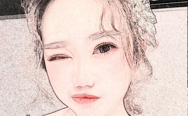 东莞西妃祛痘/痘印口碑怎么样