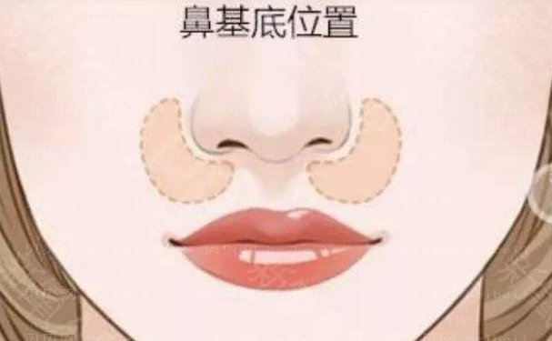 北京假体垫鼻基底医院展示,医生都有谁