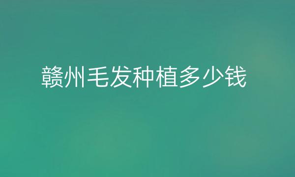 赣州毛发种植哪家医院比较好?赣州毛发种植价格参考一览