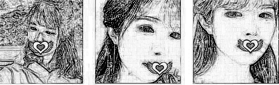 重庆美莱医美做激光祛斑介绍分享!