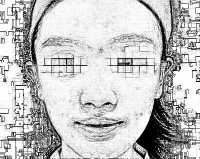 宜昌第二人民医院医学美容科光子嫩肤介绍分享!