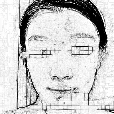 宜昌第二人民医院医学美容科光子嫩肤介绍分享!