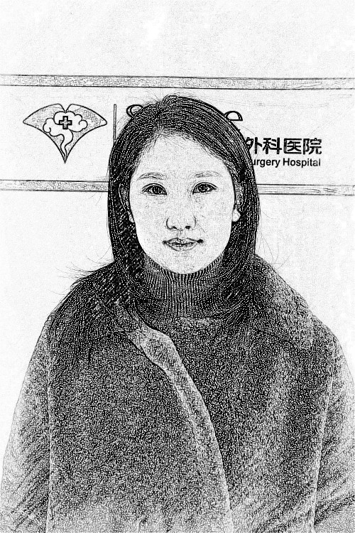 沈阳杏林整形外科医院医生朱石江下颌角整形介绍分享!