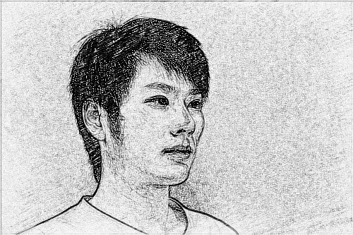杭州时光医疗美容医院医生陈小平下颌角整形介绍分享!