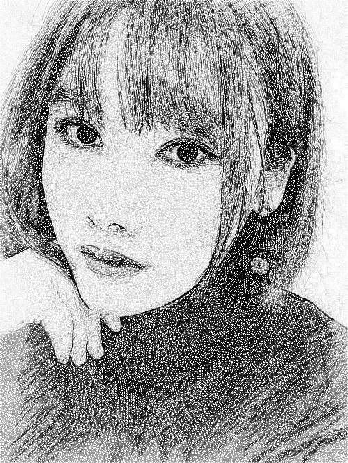 苏州美莱美容医院医生张亮鼻部多项术后60天分享!