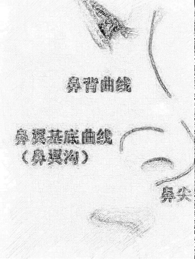 苏州双眼皮、隆鼻哪些医院医生好？