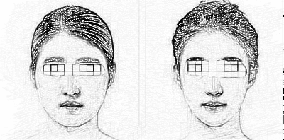 水动力吸脂瘦脸