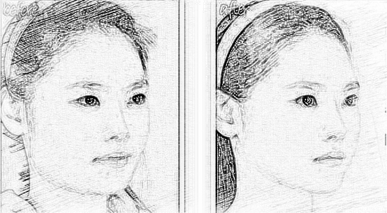 做了下颌角手术之后要多长时间才能彻底恢复呢