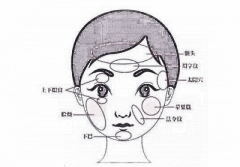 脸部凹陷颧骨土，选择颧骨内推还是太阳穴填充