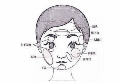脸部凹陷颧骨土，选择颧骨内推还是太阳穴填充