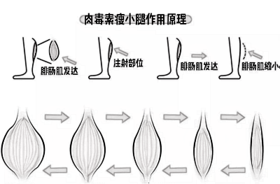 网传的{泡脚}真的可以泡瘦？