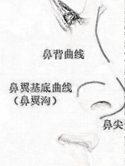 北京膨体隆鼻是不是很贵？大概要多少钱？