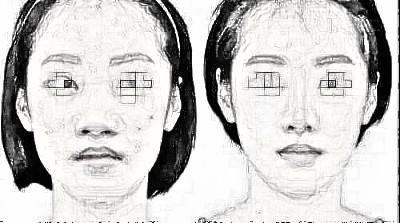 进口假体隆鼻价格多少钱?进口的质量好吗?