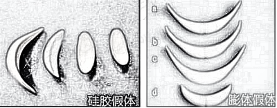 进口假体隆鼻价格多少钱？