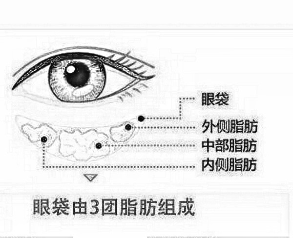 抚顺做手术调节眼袋需要多少费用，怎么个区间比较合理？