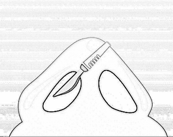 鹤岗分段式假体隆鼻价格是多少?