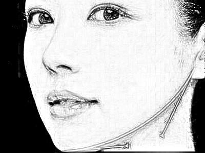 广州下颌角磨骨价格多少钱,有很多人动不动就上万了?