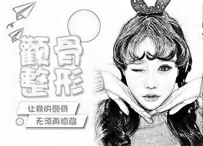 深圳颧骨内推手术价格是多少,听说收费很贵哦?