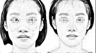 成都胶原蛋白隆鼻需要多少钱,收费为啥不一样?