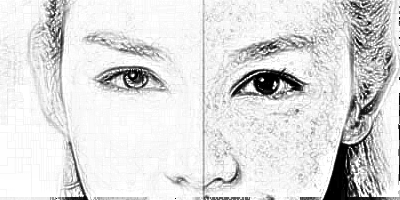 哈医大四院美容科祛斑价格大概多少?贵不贵?