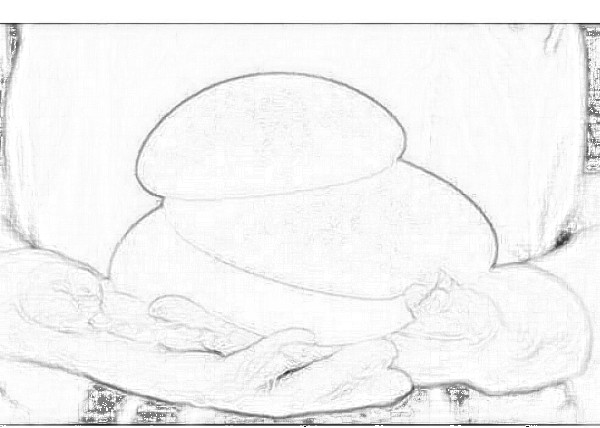 上海硅胶隆胸需要多少钱？有哪些影响因素喃？
