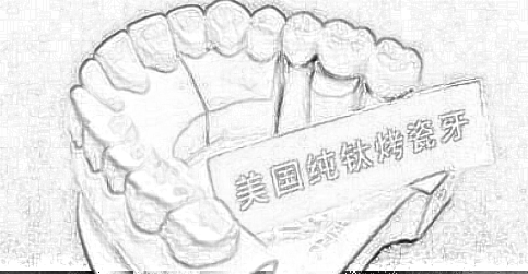青岛做纯钛烤瓷牙价格大概多少？贵不贵呢？