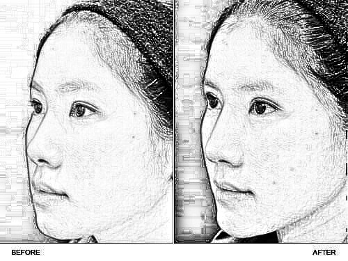 隆鼻:是走形式还是功能