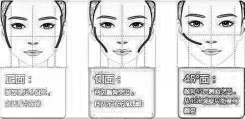 磨颧骨多少钱 真的没有风险吗